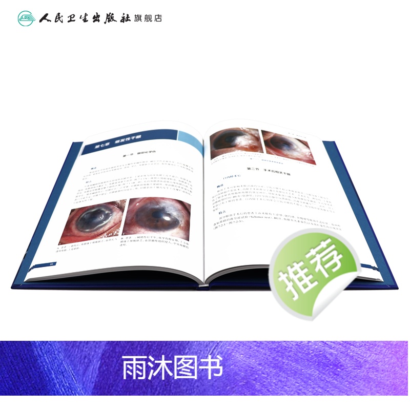 [正版]图解干眼诊疗 晋秀明徐雯主编 眼科学干眼症治疗干眼检查诊疗护理睑缘炎结膜角膜病变人民卫生出版社眼科书籍高清大图