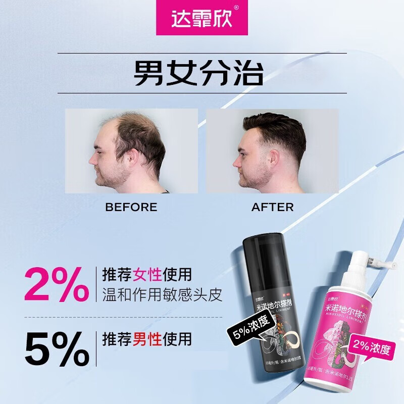 [女性适用 30ml]达霏欣 米诺地尔搽剂 30ml/盒2%浓度治疗男性型脱发和斑秃米诺地尔生发液喷雾剂旗舰店官方正品