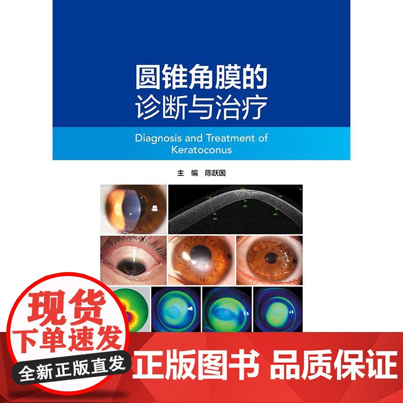 圆锥角膜的诊断与治疗 陈跃国 主编 圆锥角膜的流行病学 角膜地形图特征 供眼科医生及医学生阅读参考97871173716高清大图