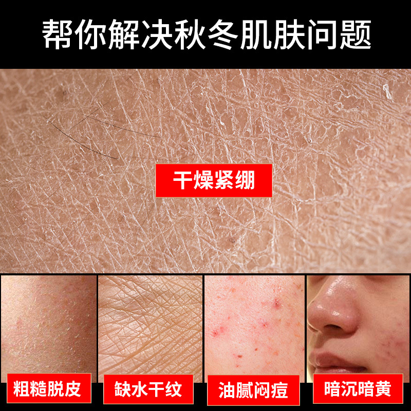男士面霜秋冬季保湿补乳液润肤脸部化妆护肤品护擦脸油脸霜