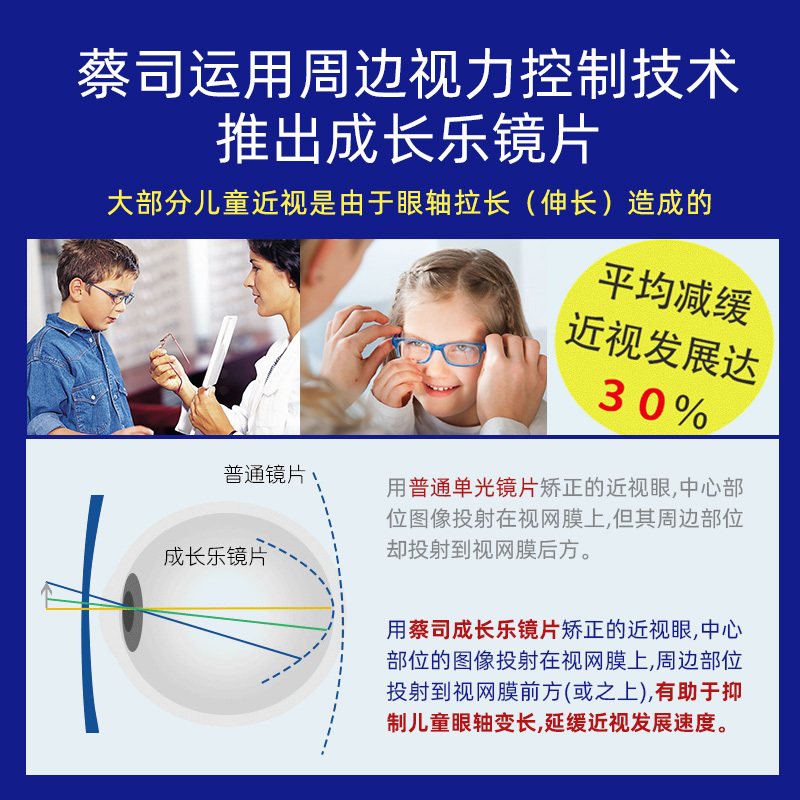 zeiss德国蔡司成长乐镜片儿童防控近视钻立方铂金膜1.5/1.6/1.67学生青少年离焦眼镜原厂