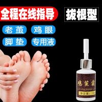 专用鸡眼膏特效手脚趾底足上鸡眼贴去除跖疣死皮猴子老茧肉刺瘊子
