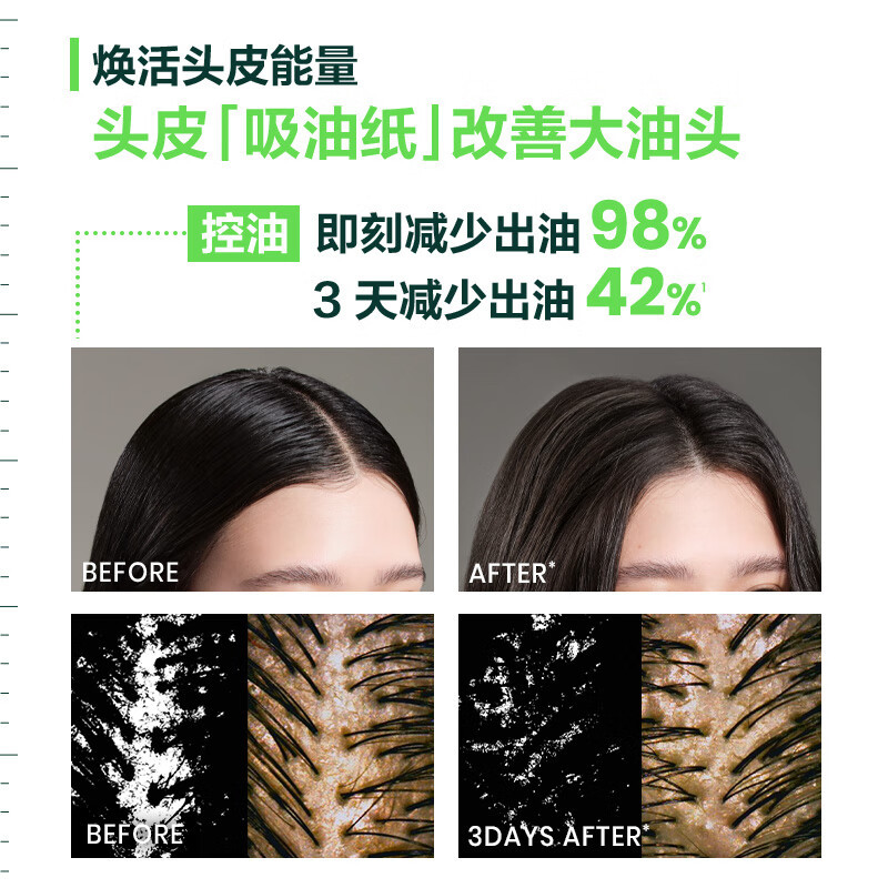 馥绿德雅小绿珠活力强韧洗发水持久清爽长效控油头皮舒缓发量蓬松无硅油洗发露洗头膏法国原装进口600ml