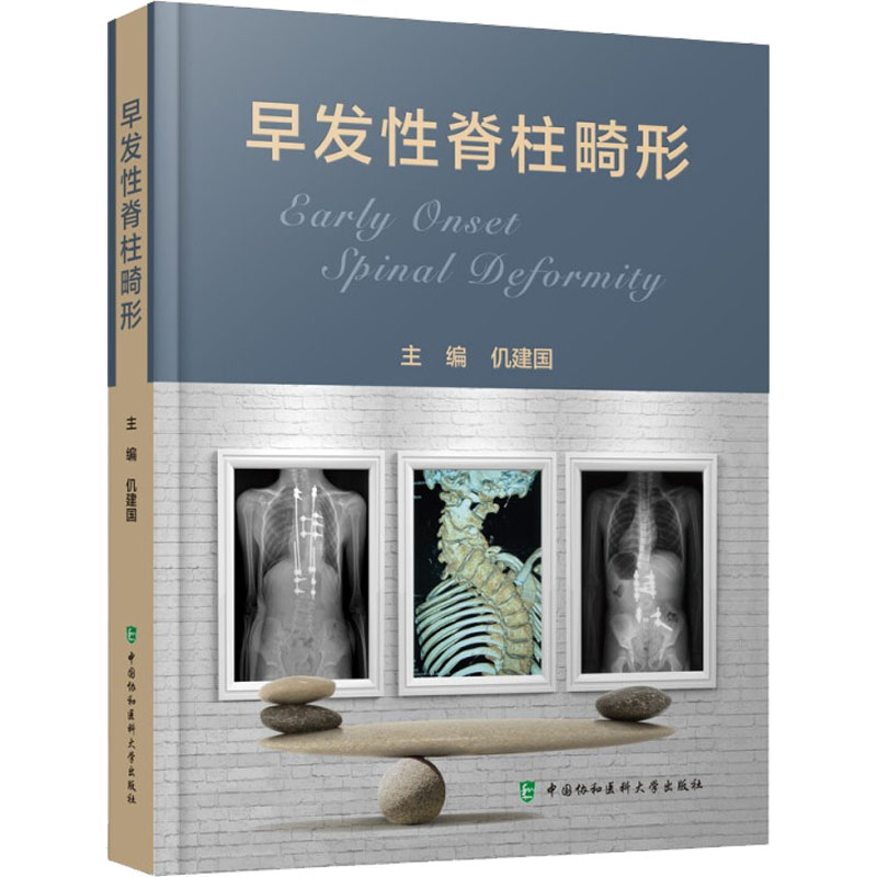 醉染图书早发脊柱畸形9787567919587高清大图