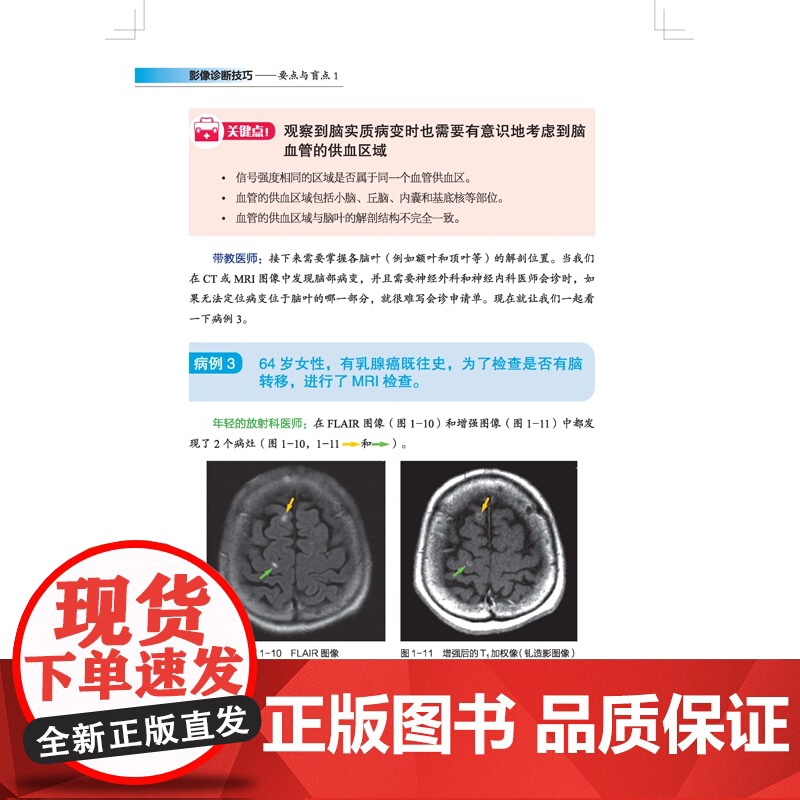 影像诊断技巧 要点与盲点1 最全肺部分段图解,纯干货免费分享! 警惕这样的肠梗阻!---你忽视的肠梗阻诊断技巧 北京科学高清大图