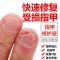 1瓶[体验装]建议购买3瓶 [官方正品]指甲快速修复液 指甲生长液护甲营养油咬指甲水修复液防断养甲改善甲床甲面快速