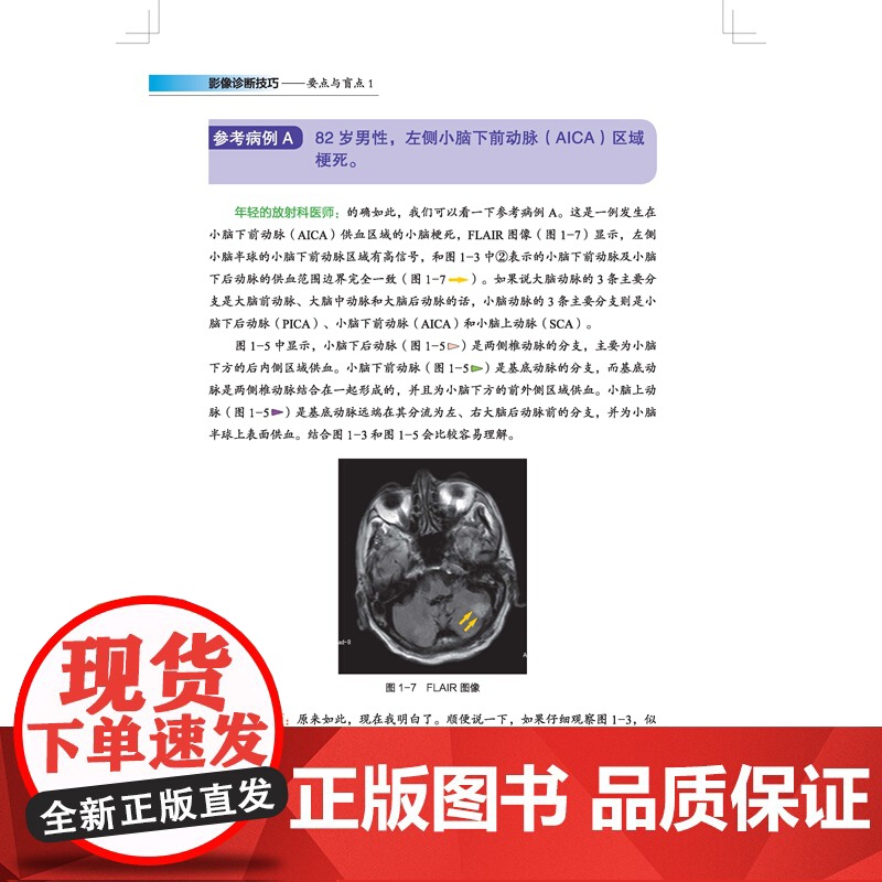 影像诊断技巧 要点与盲点1 最全肺部分段图解,纯干货免费分享! 警惕这样的肠梗阻!---你忽视的肠梗阻诊断技巧 北京科学高清大图