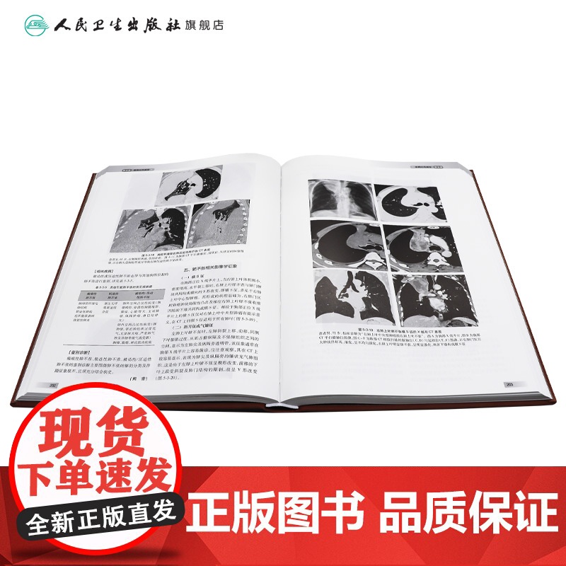 中华影像鉴别诊断学——胸部分册 2024年10月参考书高清大图