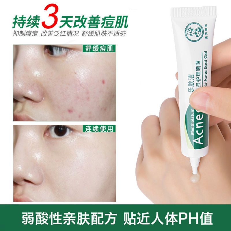 曼秀雷敦乐肤洁抗痘护理啫喱淡化痘印青春痘学生凝胶 抗痘啫喱18g