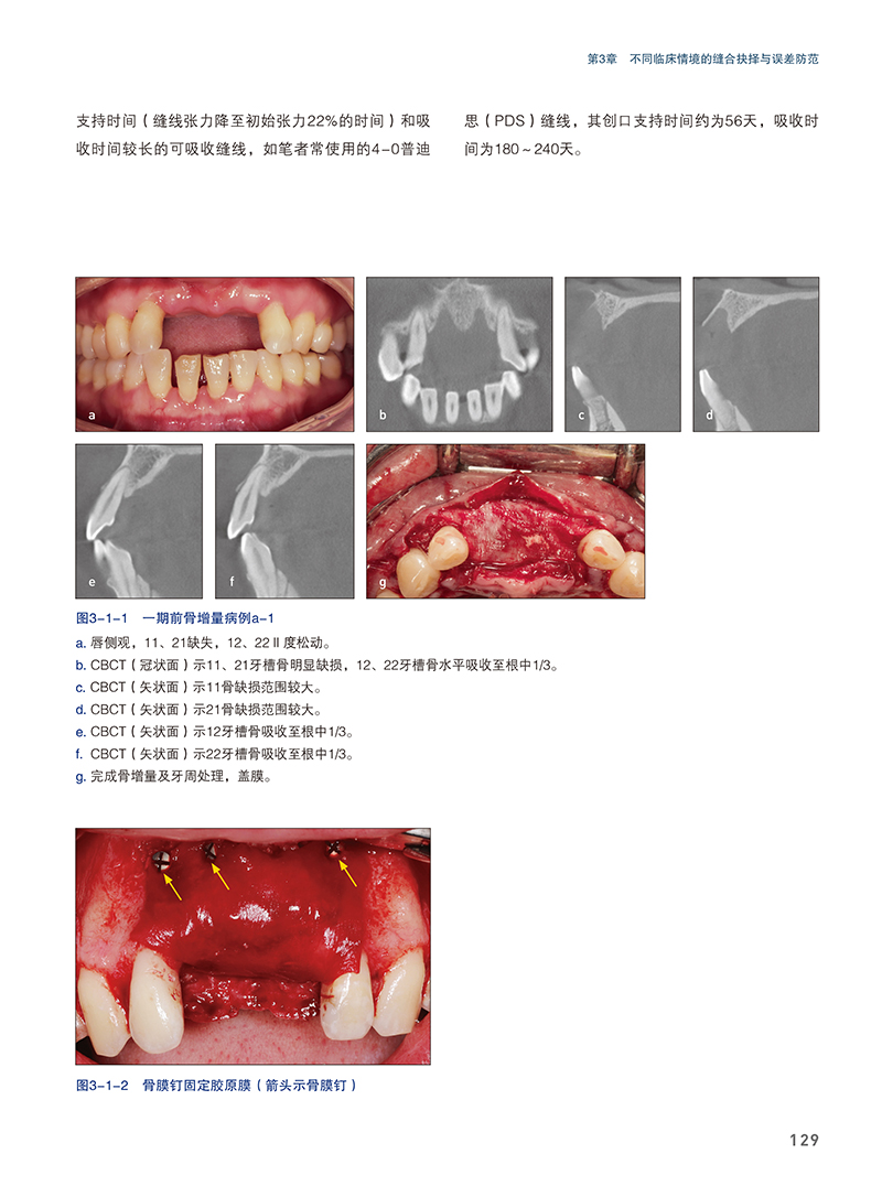 [正版]精准缝合 种植及相关术式中的应用 满毅种植牙口腔外科学缝合附手术视频 口腔牙体牙髓修复正畸口腔科学书籍 辽宁科高清大图