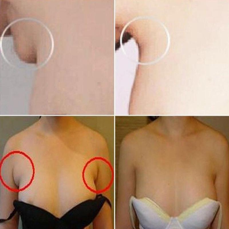 副乳贴淋巴结肿大炎贴颈部腋下排毒腹股沟硬块淋巴散结膏