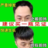 体验装[1瓶] 头发快速生长液增长增发密发生发液秃顶防脱发际线变长育发剂学生