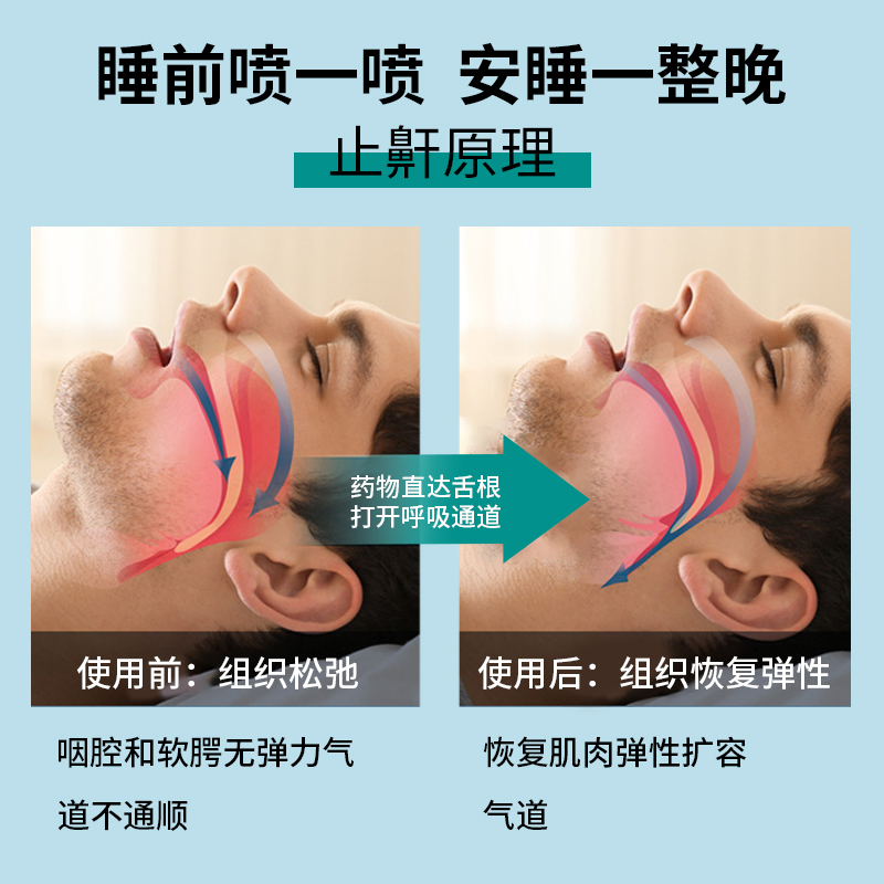 止鼾神器打呼噜消治防止打鼾声鼾立停喷剂非药家用正品防呼噜专用