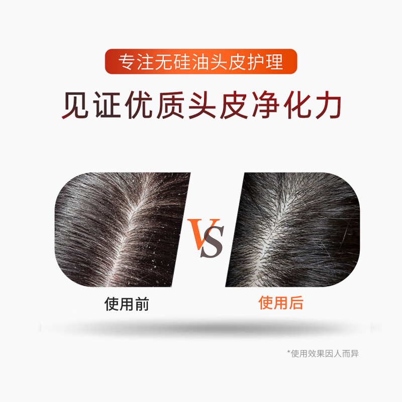 滋源(seeyoung) 男士 茶籽控油去屑 535ml 洗头水 (计价单位:瓶)高清大图