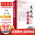 皮肤病效验秘方（第2版）李广瑞 主编化学工业出版社9787122278036医学卫生/皮肤病学/性病学