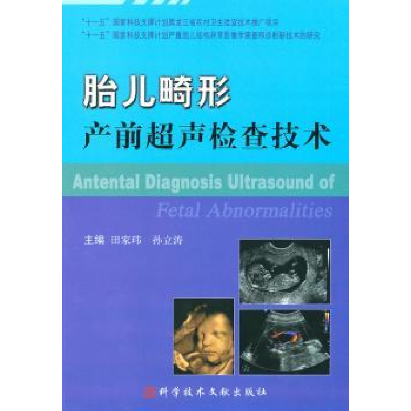 音像胎儿畸形产前超声检查技术田家玮,孙立涛主编