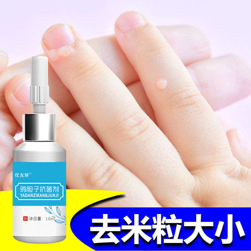 一年以内疣专用一瓶装 鸡眼膏贴去瘊子肉粒疙瘩去脖子肉粒扁平疣腋下