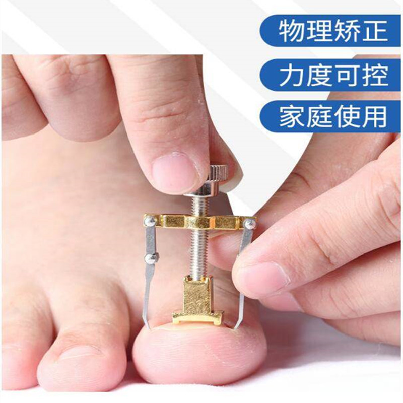 甲沟炎工具嵌甲矫正器甲沟炎指甲刀甲沟炎矫正器甲沟炎专用指甲刀
