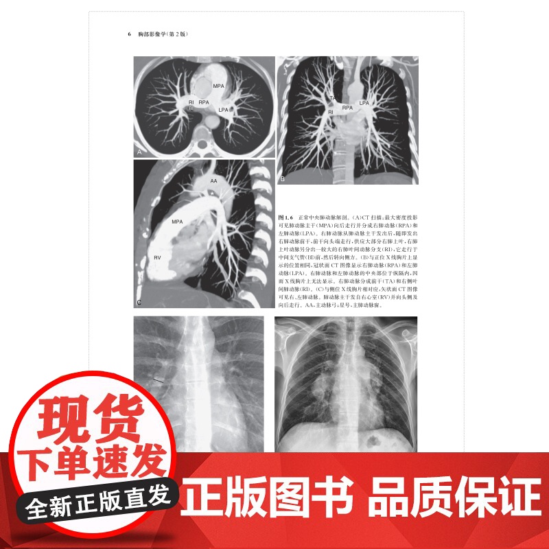 胸部影像学 [加]穆勒 影像医学 西医医学 医药卫生 主译史景云 费苛 孙鹏飞 胸部影像学解剖图谱 胸部影像学 上海科学高清大图