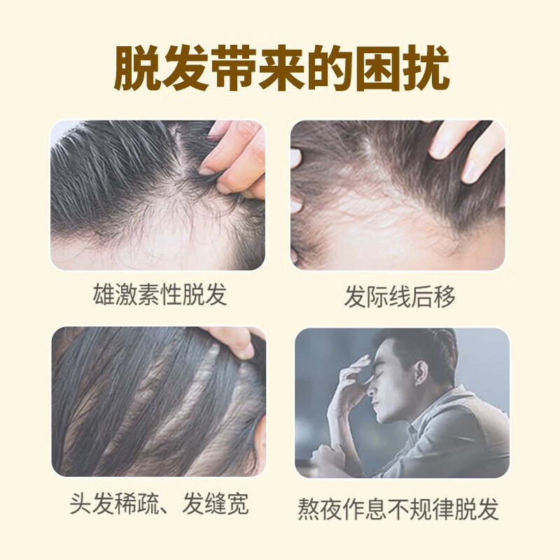 大规格]蔓迪 米诺地尔酊 90ml*2瓶/盒 曼迪男性型脱发斑秃米喏地尔酊地尔丁官方正品旗舰店曼迪蔓迪的米诺地尔酊液体剂