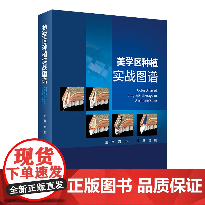 美学区种植实战图谱 谭震 口腔科学种植的精准植入技巧书籍口腔修复口腔种植学缺牙区局部整体综合评估诊疗美学种植难点及知识点高清大图