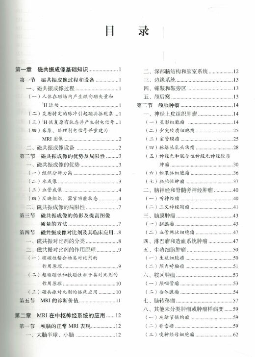 [正版] MRI读片指南 临床影像诊断丛书 夏黎明 邵剑波 孙子燕主编 可搭CT读片指南 北京大学医学出版社97875高清大图