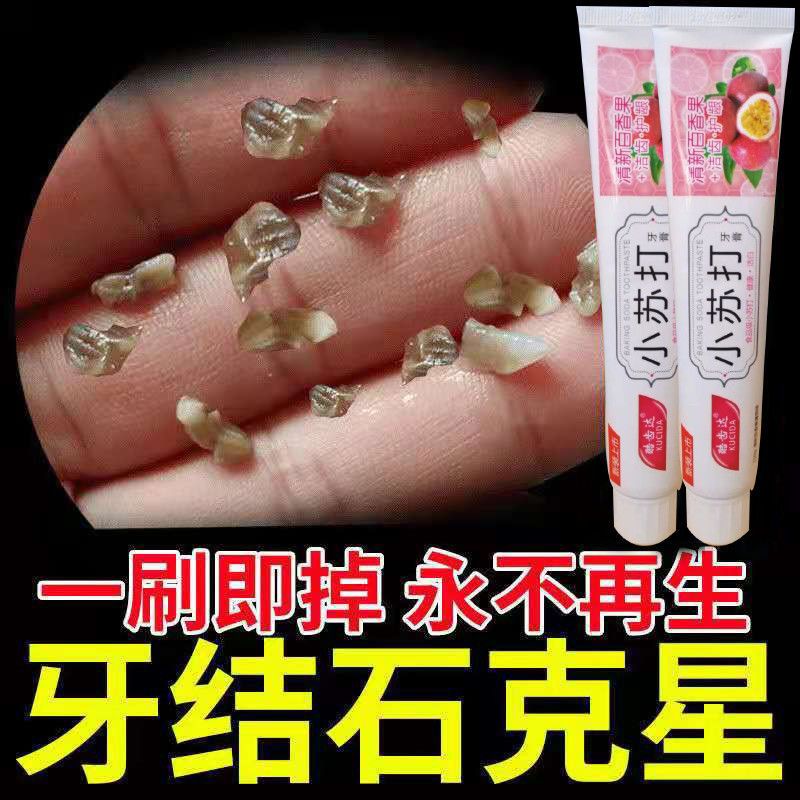 牙结石一刷秒掉一嘴去牙结石牙垢美白牙膏洗牙神器去牙渍牙膏单盒体验