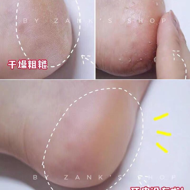 日本FootMedi足部去脚皮喷雾 脚后跟皮神器 去角质老茧110ml