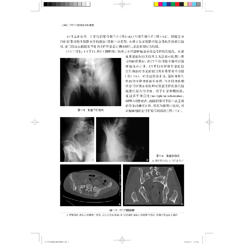 醉染图书OTC中国创伤骨科教程(第二版)9787547850879高清大图
