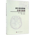 神经系统肿瘤影像与病理