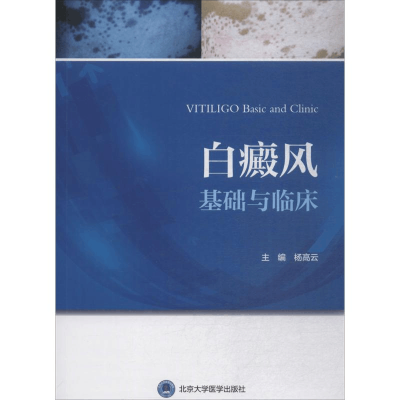 醉染图书白癜风基础与临床9787565917721图片