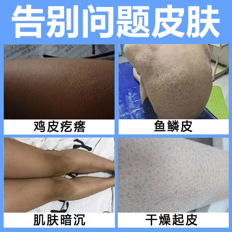 [一抹嫩]身体乳保湿补水皮肤干燥滋润持久美白香体乳去鸡皮男女 凡士林身体乳[3天美白去鸡皮] 1盒250g[滋润保湿肌肤