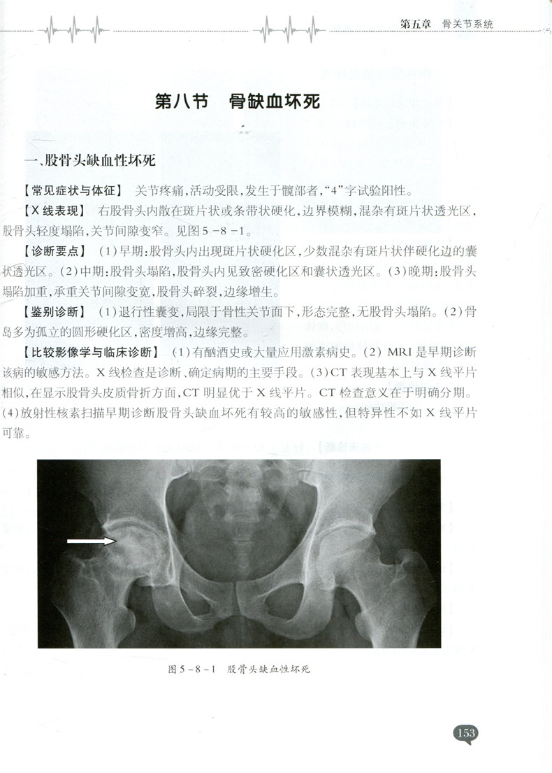 [醉染正版]手把手教你学X线诊断 主编鹿强 李会超 临床医师影像读片经典系列 医学影像图谱 x线诊断学 辽宁科技 978高清大图