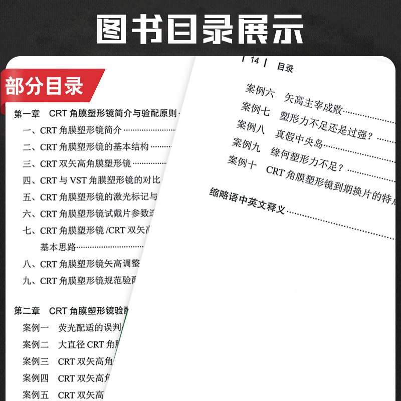 [正版]角膜塑形镜验配经典案例解析 陈志 编著 CRT的经验总结打通VSTCRT镜片验配知识 眼科学验光师书籍角膜地形