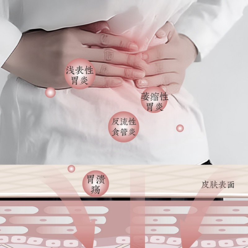 国药传承胃反流贴食管反流贴胃舒贴养胃贴高清大图