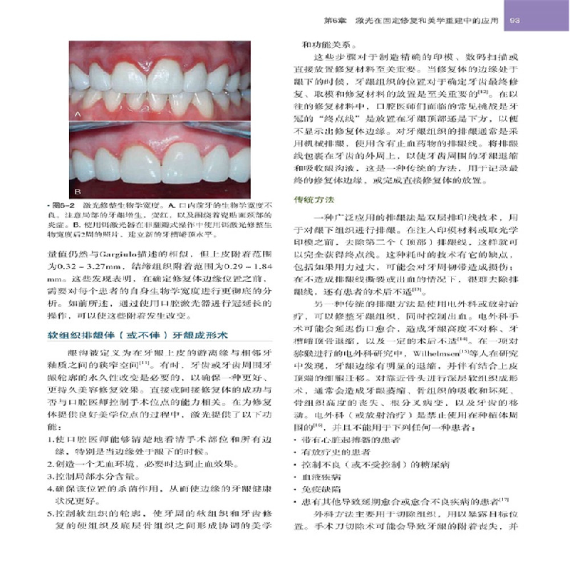 醉染图书老年患者的口腔种植治疗9787559107725高清大图