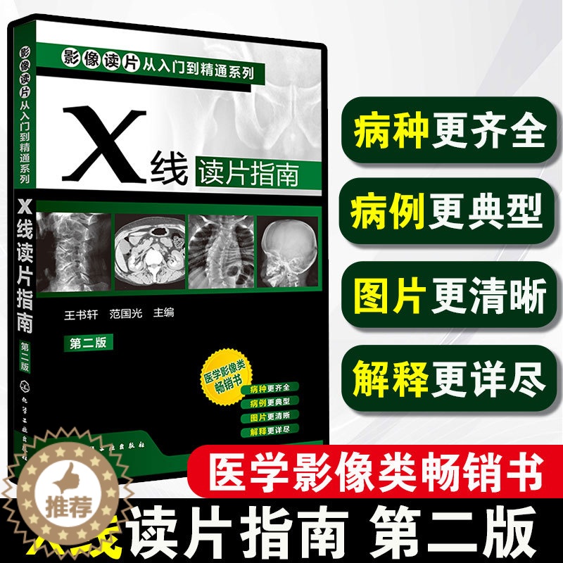 【醉染正版】正版 X线读片指南 第二版 影像读片从入门到精通系列 基层影像医生常备 影像入门读片入门 医学影像类图书