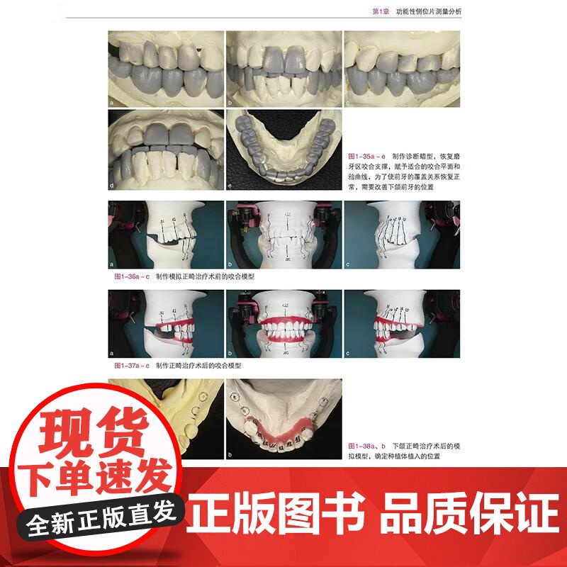 [出版社]口腔综合修复策略 咬合功能重建 土屋贤司著 种植修复口腔咬合治疗修复治疗策略种植体咬合变化 辽宁科学技术出版社高清大图