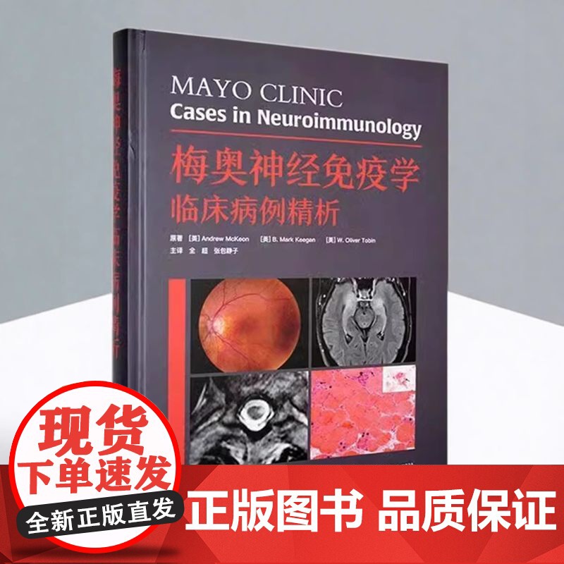 正版 梅奥神经免疫学临床病例精析 (美)安德鲁 麦基恩 原著 全超主译中枢神经系统脱髓鞘疾病中国科学技术出版社 临床医学高清大图