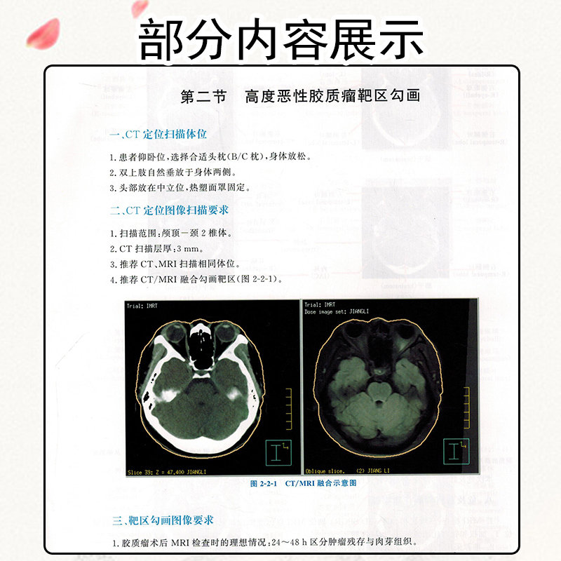 [正版] 肿瘤精准放疗靶区勾画图谱 主编袁双虎 宋启斌 肿瘤疾病临床案例诊治教程 内科学参考书籍 湖北科学技术出版社9
