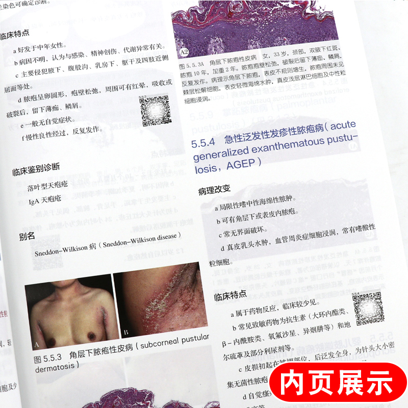 [正版]实用皮肤组织病理学 第二2版高天文王雷廖文俊皮肤病理肿瘤科病理科医生人民卫生出版社结构模式分类病理与临床图97高清大图