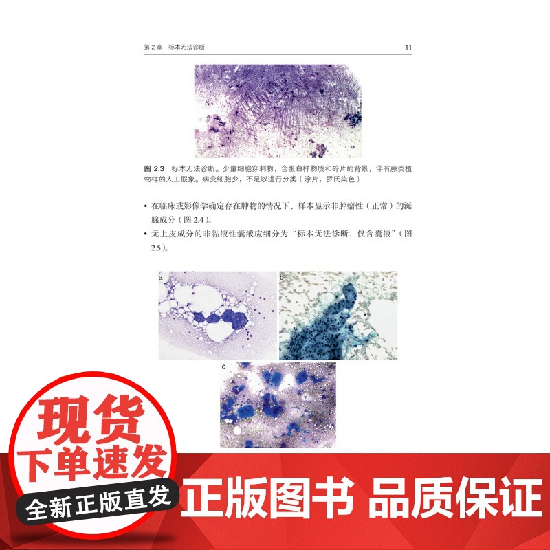 涎腺细胞病理学米兰报告系统 北京科学技术高清大图