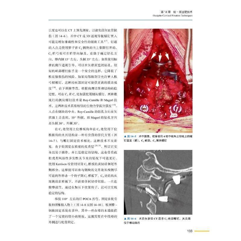 [正版] 上颈椎外科学 高延征 马向阳主译 医药卫生书籍 颅颈交界区疾病治疗 全面多类技术详解 中国科学技术出版社978