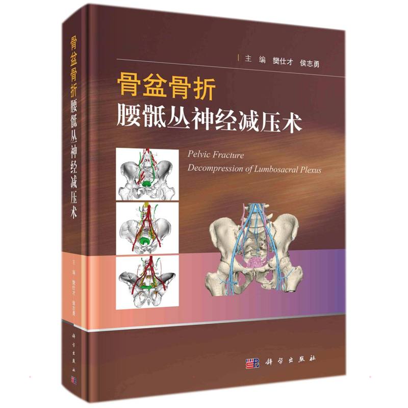 骨盆骨折腰骶丛神经减压术