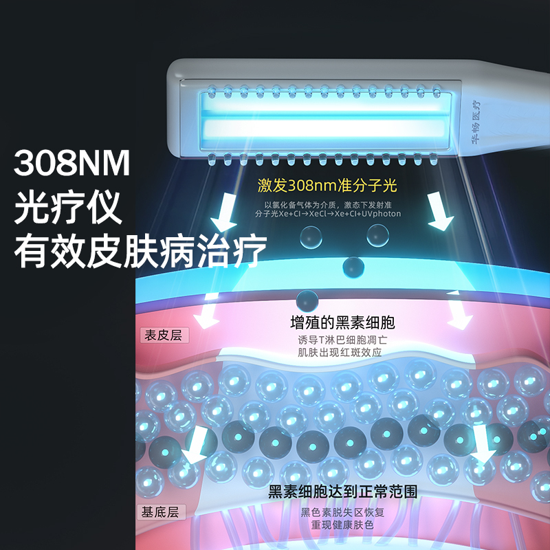 白癜风治疗仪准分子308nm光疗仪紫外线灯家用311uvb银屑病光疗机