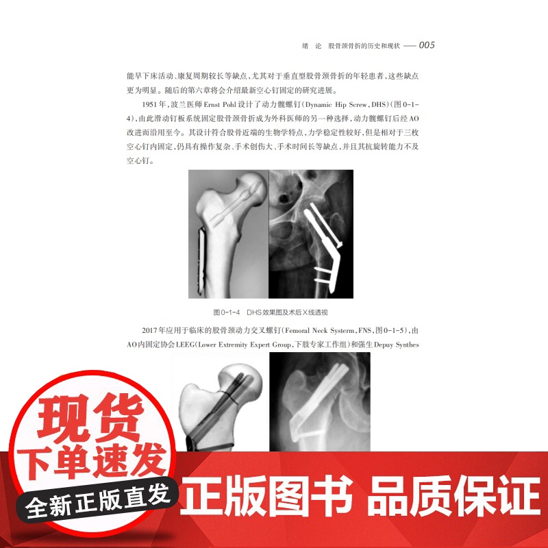 股骨颈骨折诊疗体系构建与新理念新技术 上海科技教育出版社外科学中西医股骨颈骨折院前处理评估康复护理正版医学书籍高清大图