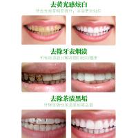 洗牙粉牙齿美白 洁牙粉白牙素去黄牙吸烟人群去烟渍牙贴非牙膏非熹药堂 50g