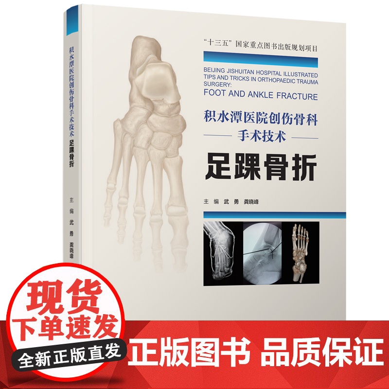 积水潭医院创伤骨科手术技术 足踝骨折 北京积水潭医院手术经验全景展示 北京科学技术高清大图