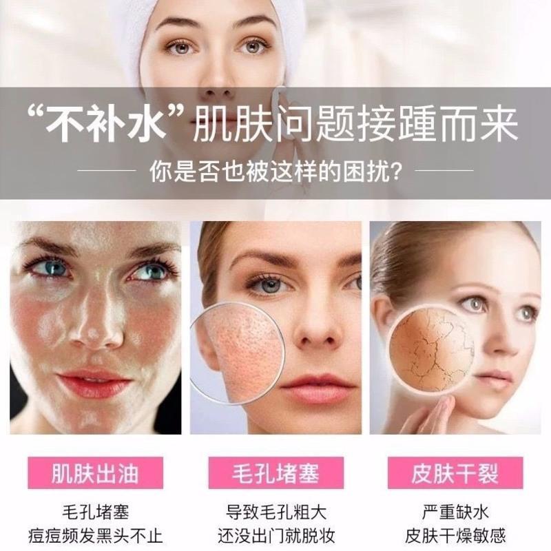 纳米喷雾补水仪蒸脸器加大雾排毒美白家用补水仪喷雾器补水新升级 尊贵白色 热喷蒸脸器(无赠品)