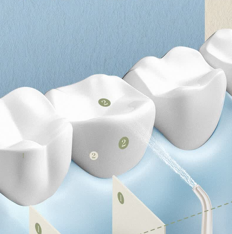 ApiYoo apiyoo艾优电动冲牙器便携式家用洗牙器牙垢牙齿清洗水牙线 X11米白色 1支喷头高清大图